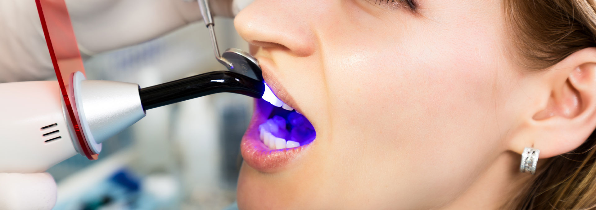 The image shows a person receiving dental treatment, with a dental hygienist using an ultrasonic cleaning device to clean their teeth.