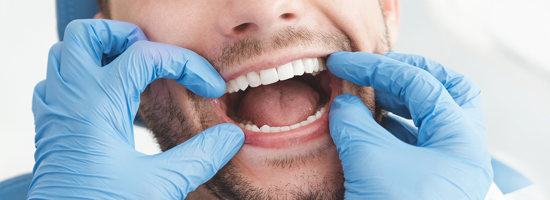 A man in a medical setting, wearing gloves and a mask, is holding his mouth open with his hands, possibly in the context of dental care or oral examination.