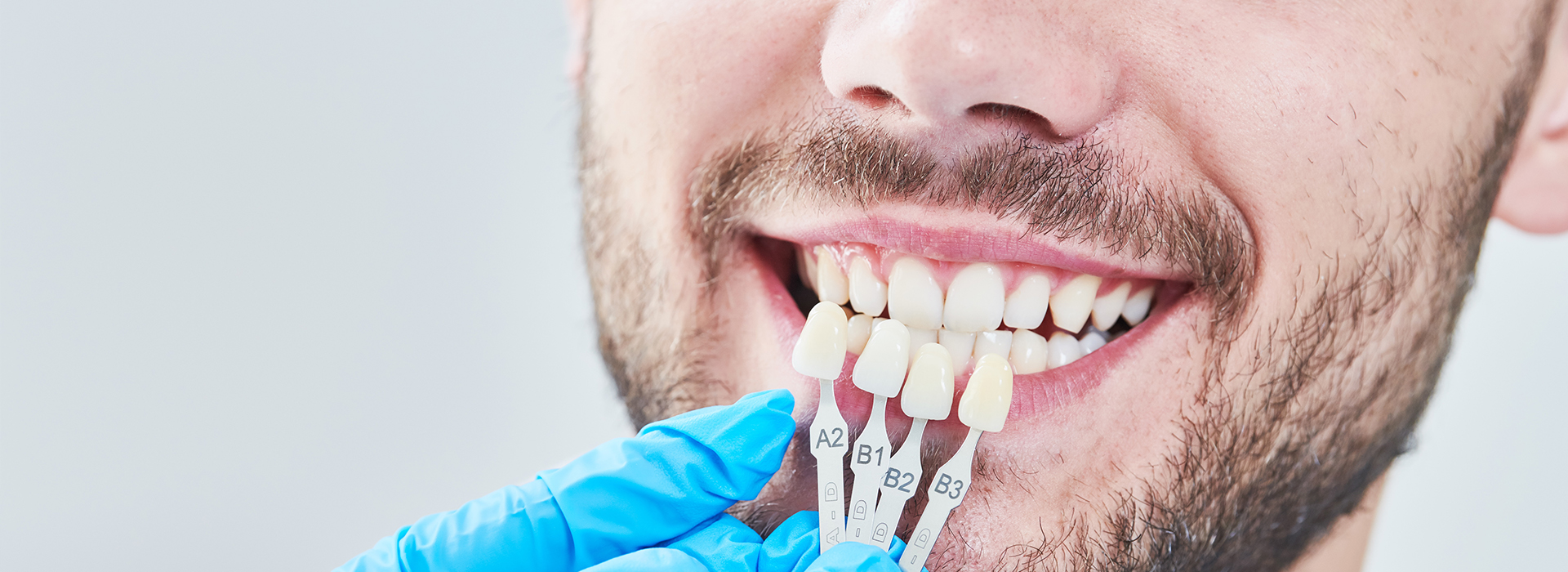 Man undergoing dental procedure with smiling expression.