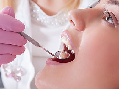 This image features a dental professional performing a dental procedure, with the patient s mouth open and an instrument being used to treat the teeth.